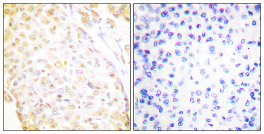 Nkx-3.1 Rabbit Polyclonal Antibody