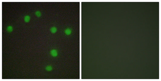 Nkx-6.3 Rabbit Polyclonal Antibody