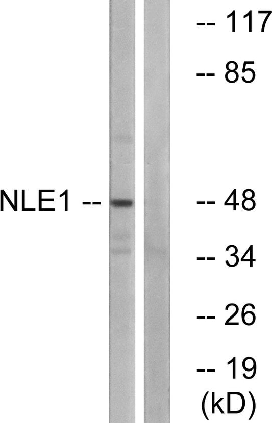 NLE1 Rabbit Polyclonal Antibody