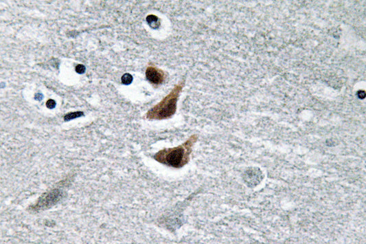 NM23-H1 Rabbit Polyclonal Antibody