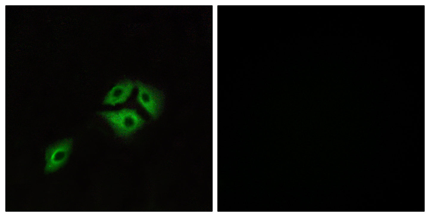NMBR Rabbit Polyclonal Antibody