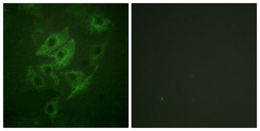 NMDAε1/2 Rabbit Polyclonal Antibody