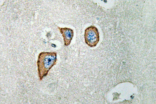 NMDAε3 Rabbit Polyclonal Antibody