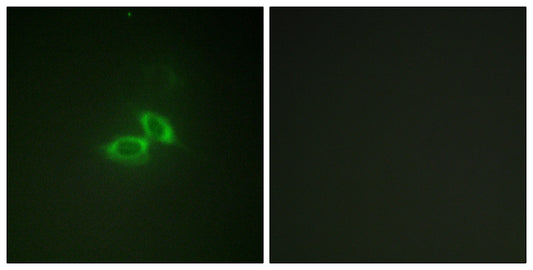 NMDAζ1 Rabbit Polyclonal Antibody