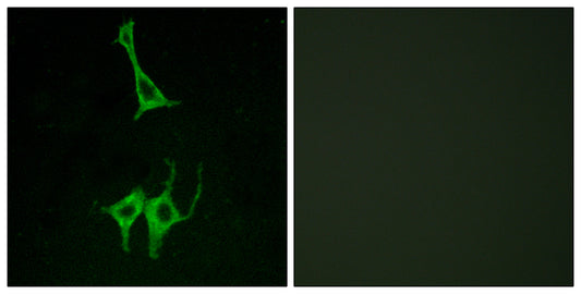 NMUR1 Rabbit Polyclonal Antibody