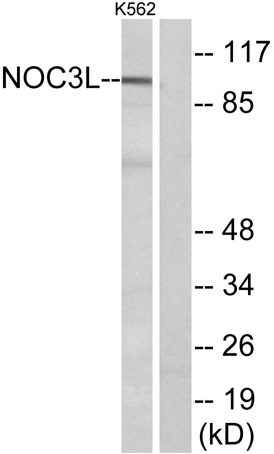 NOC3L Rabbit Polyclonal Antibody