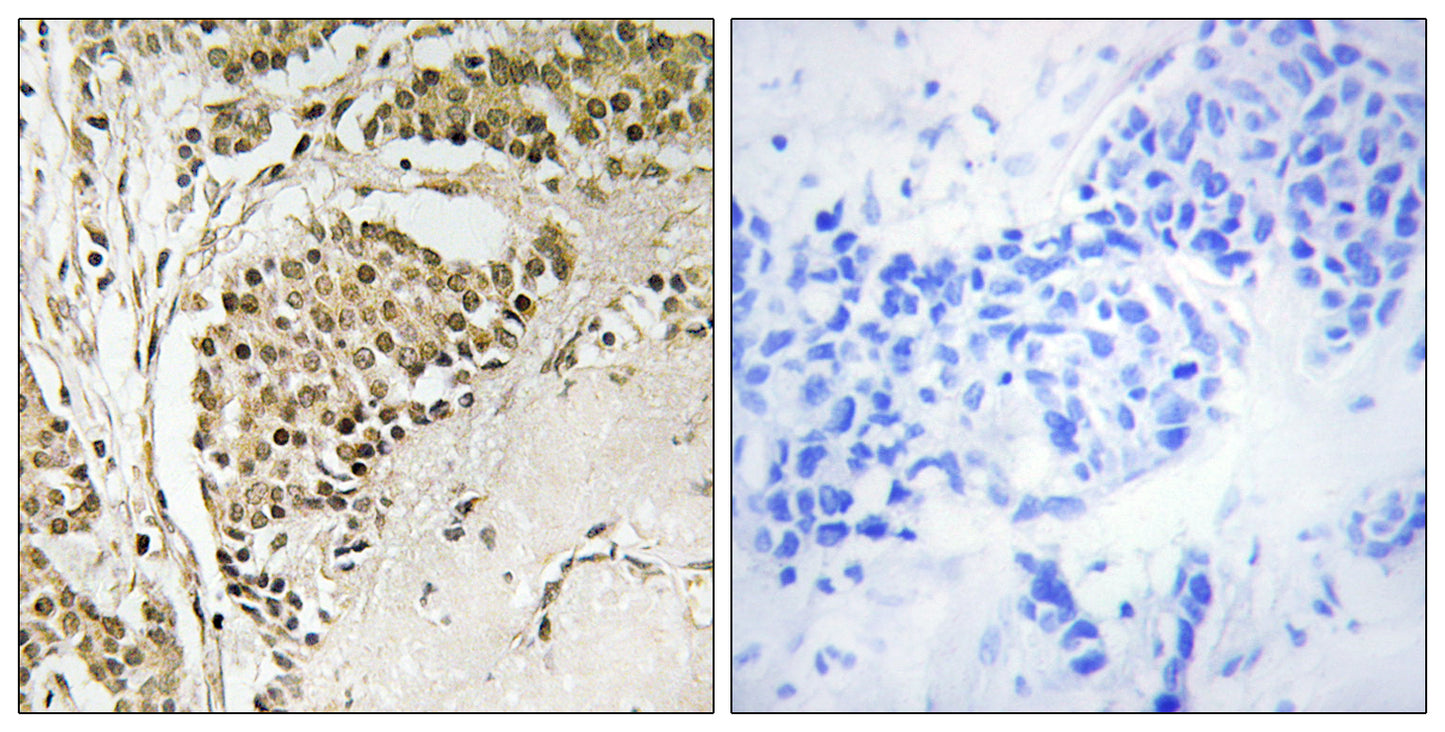 NOM1 Rabbit Polyclonal Antibody