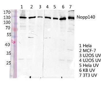 Nopp140 Rabbit Polyclonal Antibody