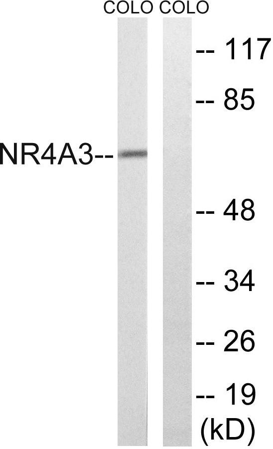 NOR-1 Rabbit Polyclonal Antibody