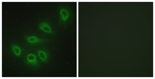 NOS3 Rabbit Polyclonal Antibody
