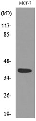 Nov Rabbit Polyclonal Antibody