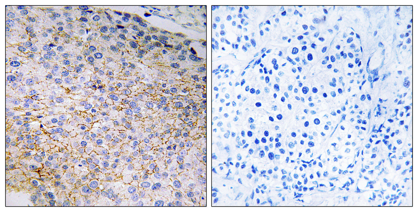 Nox3 Rabbit Polyclonal Antibody