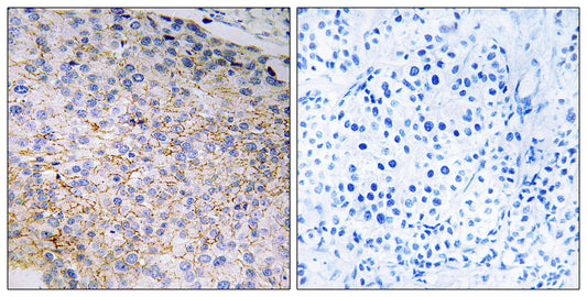 Nox3 Rabbit Polyclonal Antibody