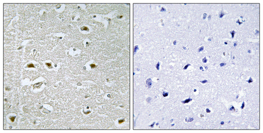 NPA1 Rabbit Polyclonal Antibody