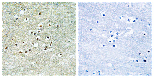 NPAS4 Rabbit Polyclonal Antibody
