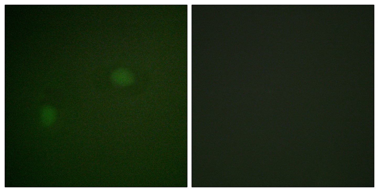NPM Rabbit Polyclonal Antibody