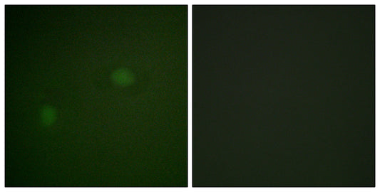 NPM Rabbit Polyclonal Antibody