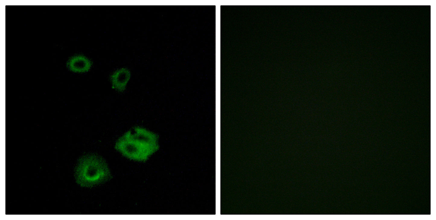 NPY2-R Rabbit Polyclonal Antibody