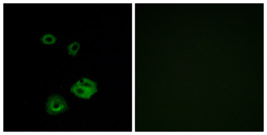 NPY2-R Rabbit Polyclonal Antibody