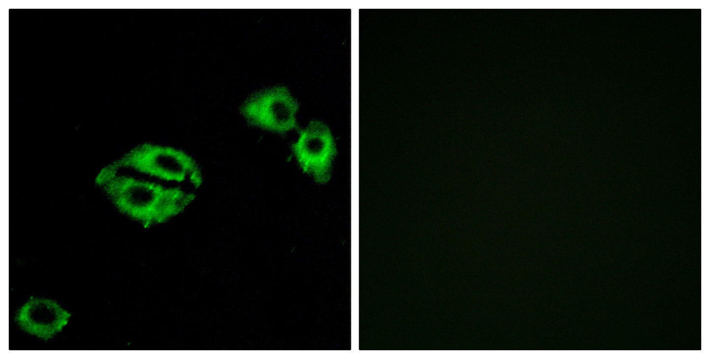 NPY5-R Rabbit Polyclonal Antibody