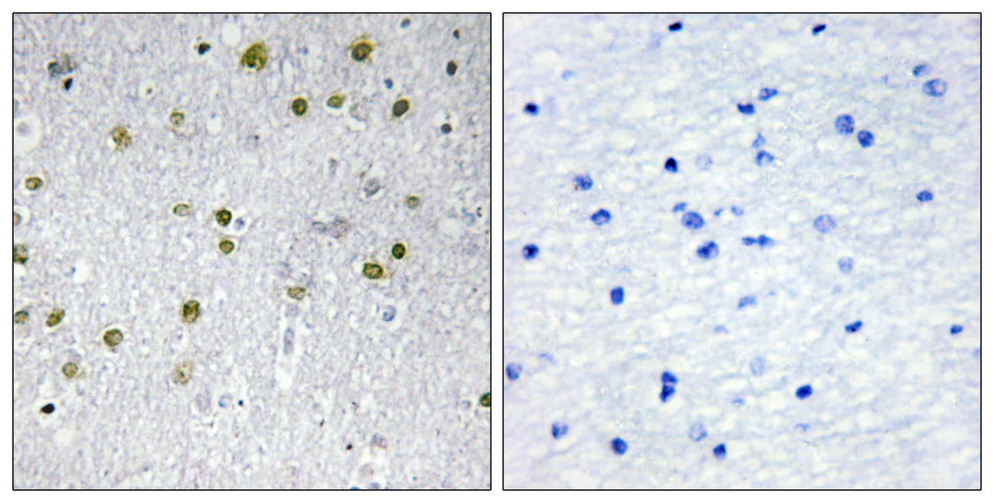 NRIP2 Rabbit Polyclonal Antibody