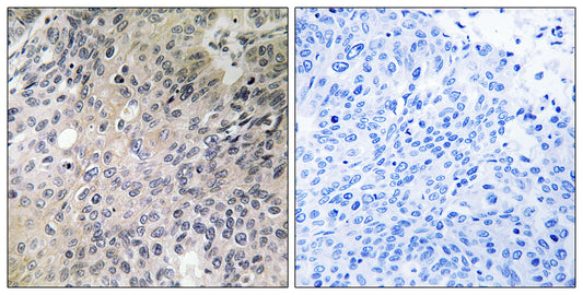 N-Shc Rabbit Polyclonal Antibody