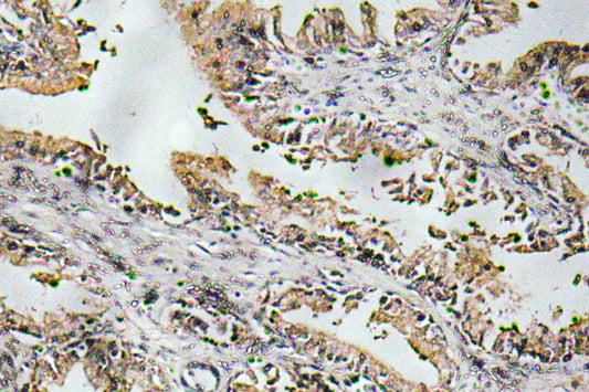 NT-4 Rabbit Polyclonal Antibody