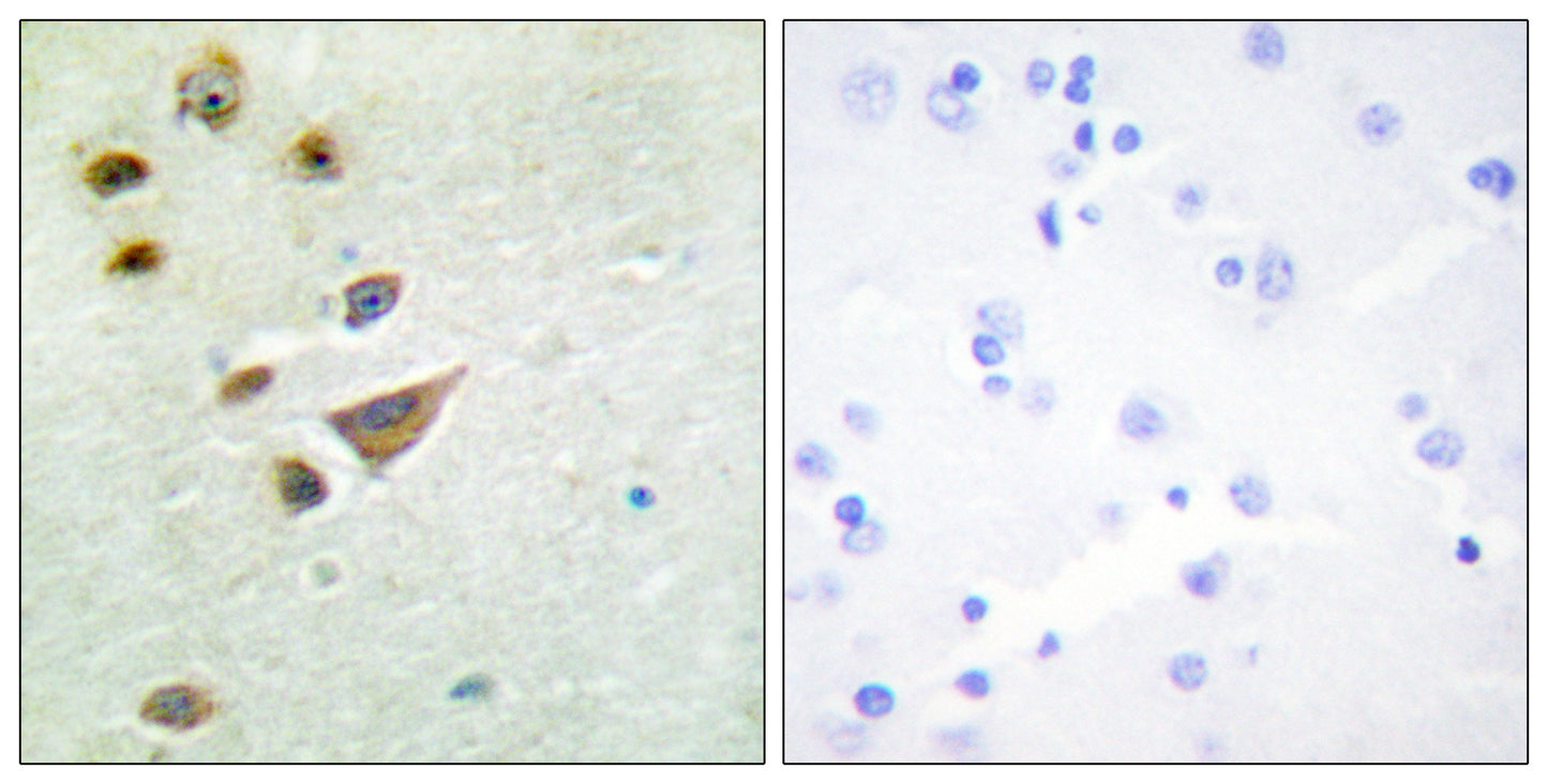 NT5C3 Rabbit Polyclonal Antibody