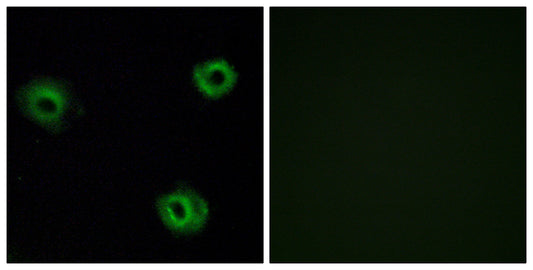 NTR2 Rabbit Polyclonal Antibody