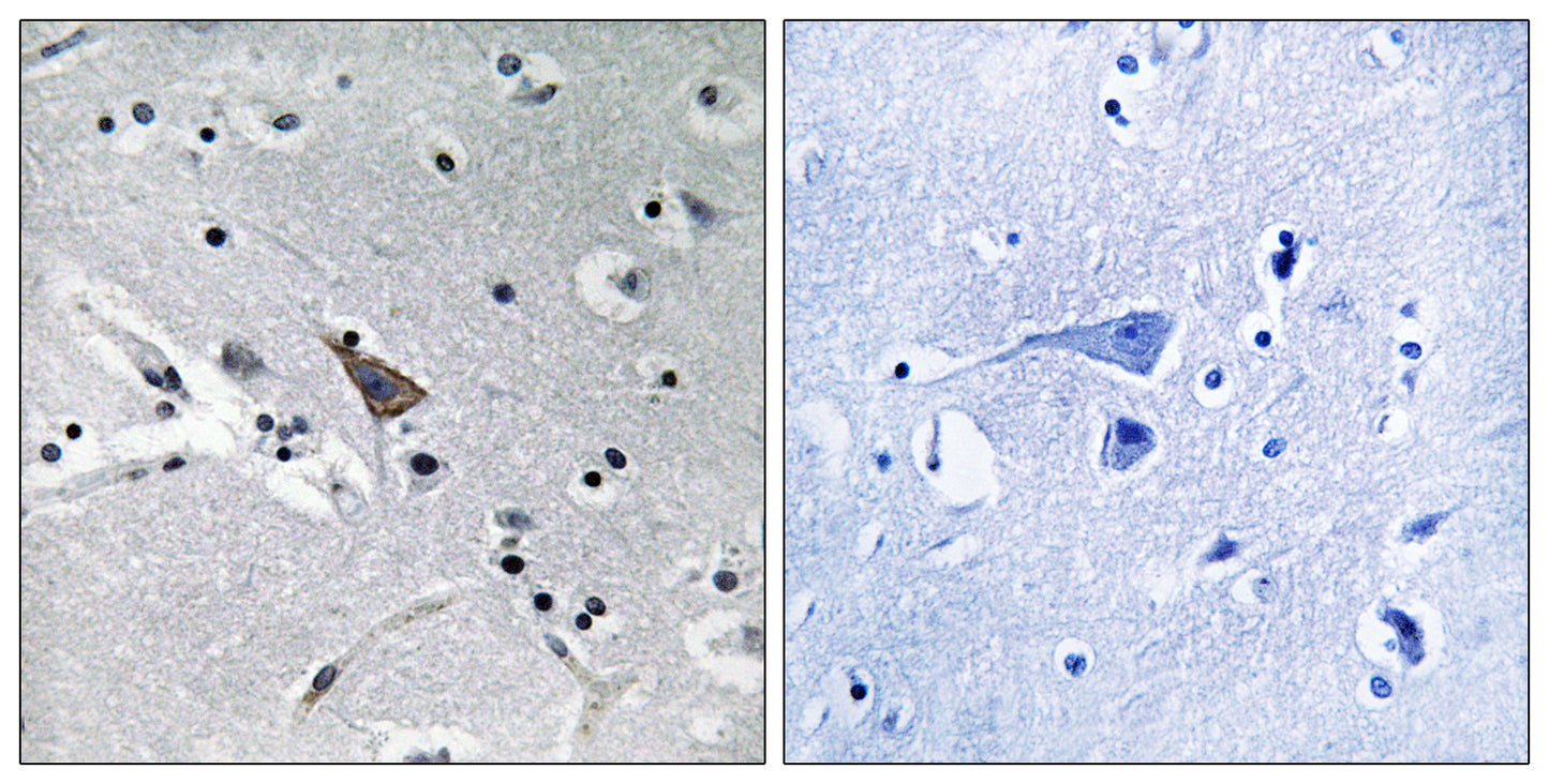 NTT5 Rabbit Polyclonal Antibody