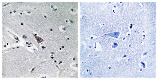 NTT5 Rabbit Polyclonal Antibody