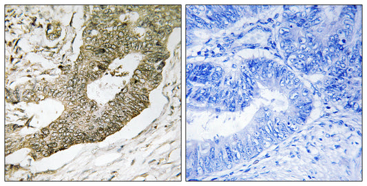 NUCKS Rabbit Polyclonal Antibody