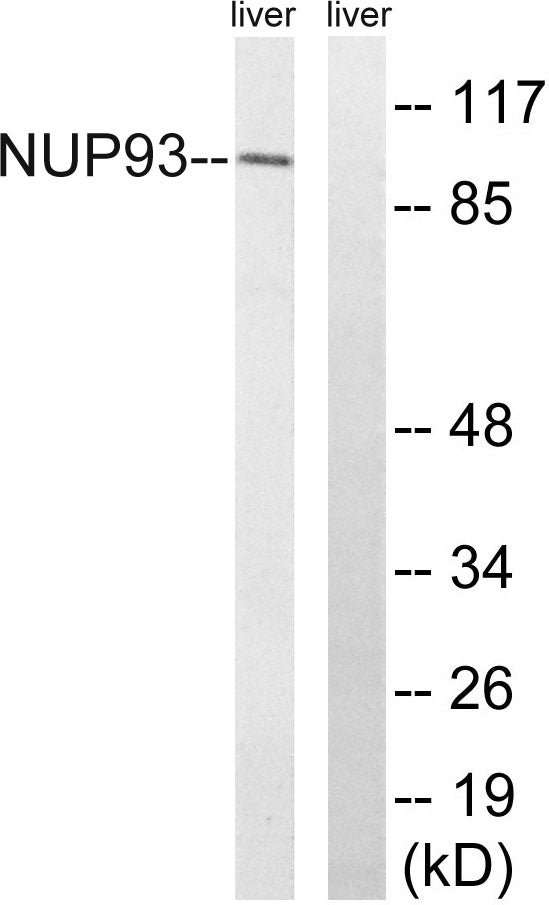 Nup93 Rabbit Polyclonal Antibody