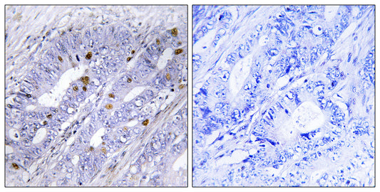 Nur77 Rabbit Polyclonal Antibody