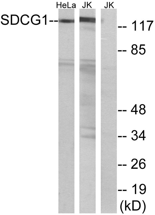 NY-CO-1 Rabbit Polyclonal Antibody