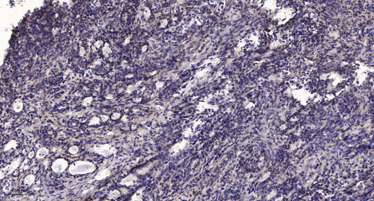 NY-CO-8 Rabbit Polyclonal Antibody