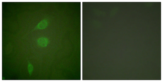 NY-CO-9 Rabbit Polyclonal Antibody