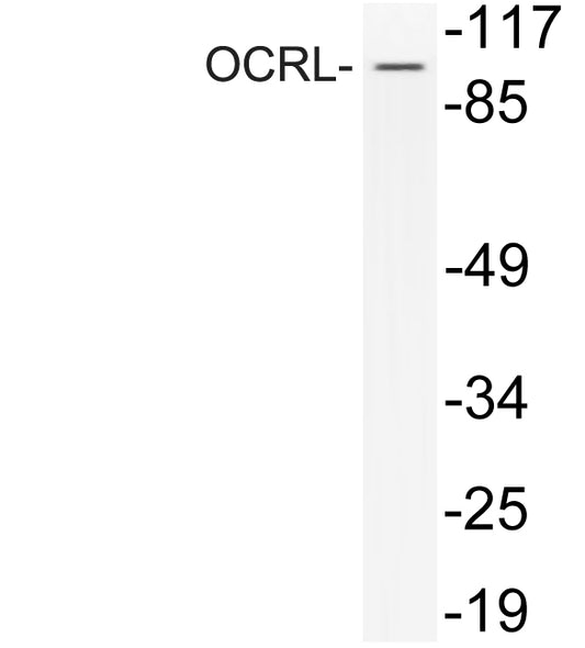 OCRL Rabbit Polyclonal Antibody