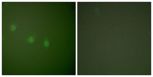 Oct-2 Rabbit Polyclonal Antibody