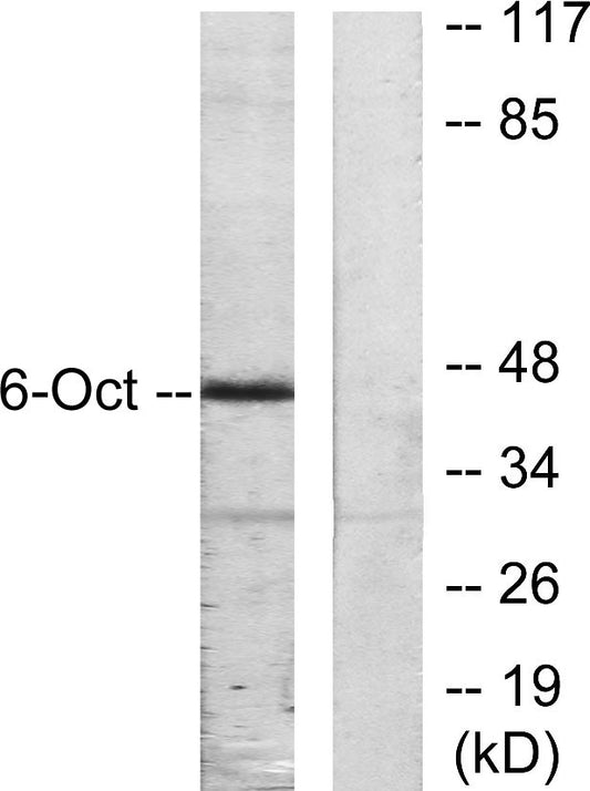Oct-6 Rabbit Polyclonal Antibody