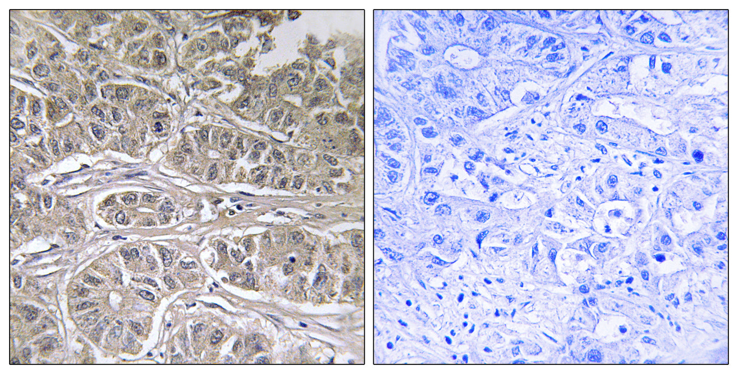 ODC Rabbit Polyclonal Antibody