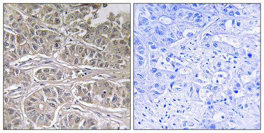 ODC Rabbit Polyclonal Antibody
