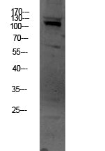 OGT Rabbit Polyclonal Antibody