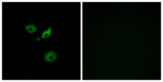 Olfactory receptor 10AD1 Rabbit Polyclonal Antibody
