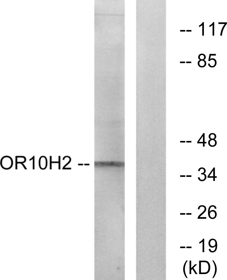 Olfactory receptor 10H2 Rabbit Polyclonal Antibody