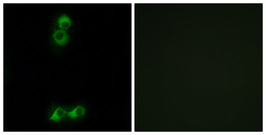 Olfactory receptor 10J5 Rabbit Polyclonal Antibody
