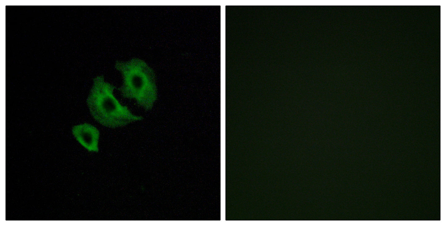 Olfactory receptor 10J6 Rabbit Polyclonal Antibody