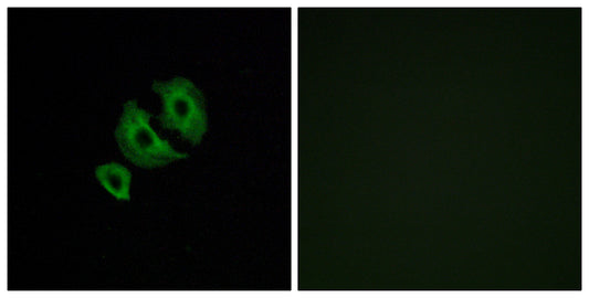 Olfactory receptor 10J6 Rabbit Polyclonal Antibody