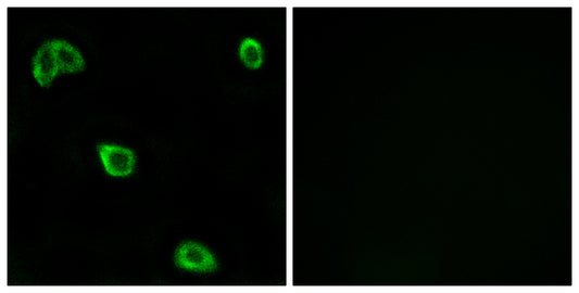 Olfactory receptor 10K1/2 Rabbit Polyclonal Antibody