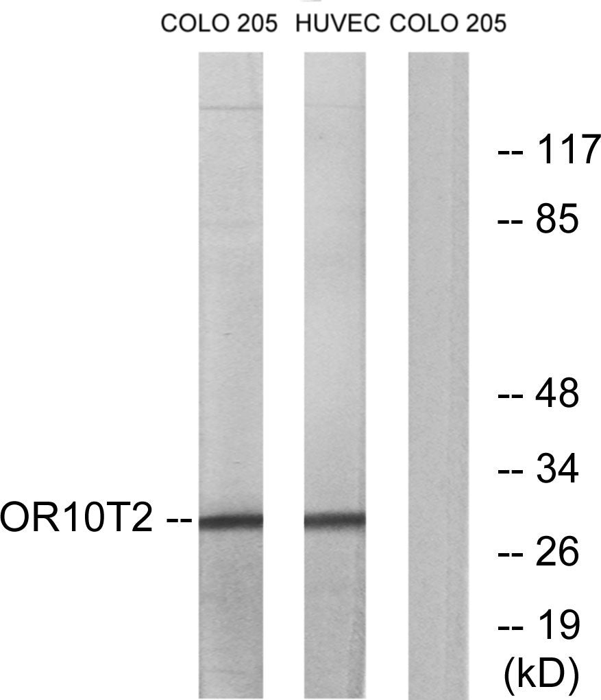 Olfactory receptor 10T2 Rabbit Polyclonal Antibody